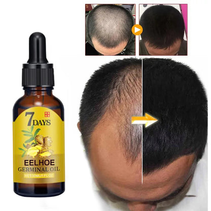 Ginger Hair Growth Serum – Prevent Hair Loss, Strengthen Roots & Boost Shine | Natural Herbal Scalp Treatment by EELHOE