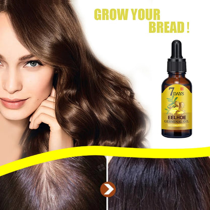 Ginger Hair Growth Serum – Prevent Hair Loss, Strengthen Roots & Boost Shine | Natural Herbal Scalp Treatment by EELHOE