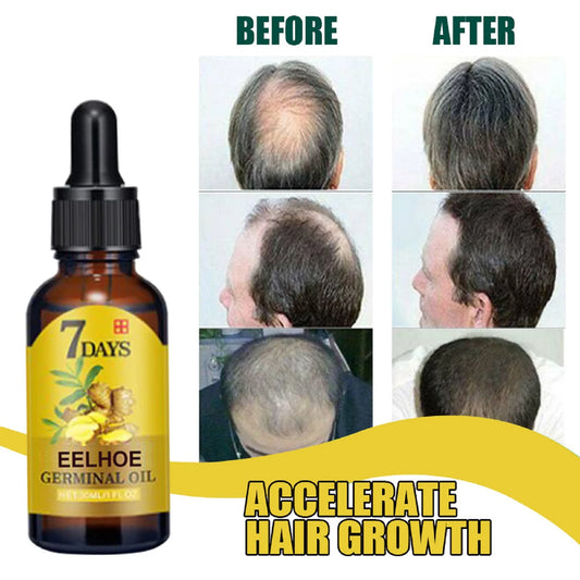 Ginger Hair Growth Serum – Prevent Hair Loss, Strengthen Roots & Boost Shine | Natural Herbal Scalp Treatment by EELHOE